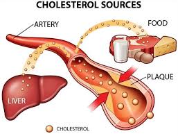 6 yếu tố nguy cơ làm tăng cholesterol máu